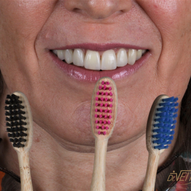 https_drveit.com.br_casos-clinicos_reabilitacao-oral-transdisciplinar-5__6