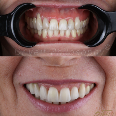 https_drveit.com.br_casos-clinicos_reabilitacao-oral-transdisciplinar-5__7