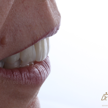 https_drveit.com.br_casos-clinicos_reabilitacao-oral-transdisciplinar-5__8