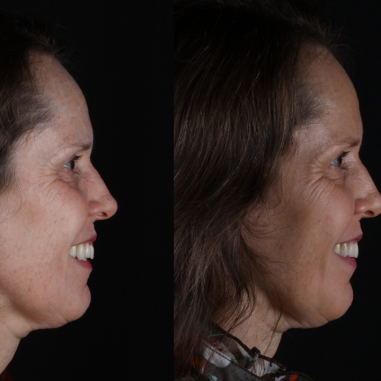 https_drveit.com.br_casos-clinicos_reabilitacao-oral-transdisciplinar-5__9