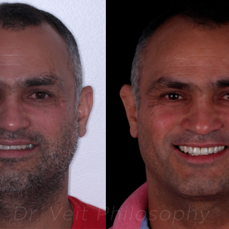 https_drveit.com.br_casos-clinicos_reabilitacao-oral-transdisciplinar-6__1