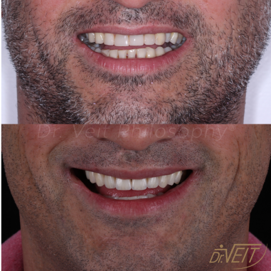 https_drveit.com.br_casos-clinicos_reabilitacao-oral-transdisciplinar-6__5