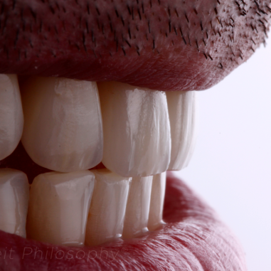 https_drveit.com.br_casos-clinicos_reabilitacao-oral-transdisciplinar-6__9