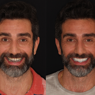 https_drveit.com.br_casos-clinicos_reabilitacao-oral-transdisciplinar-7__1