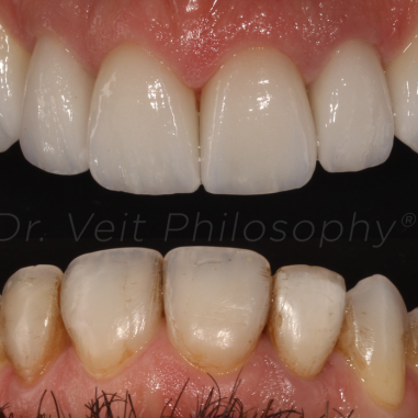 https_drveit.com.br_casos-clinicos_reabilitacao-oral-transdisciplinar-7__3