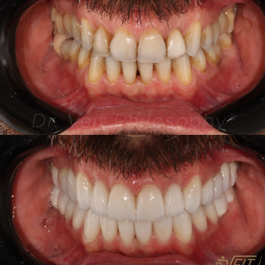 https_drveit.com.br_casos-clinicos_reabilitacao-oral-transdisciplinar-7__4