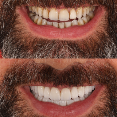 https_drveit.com.br_casos-clinicos_reabilitacao-oral-transdisciplinar-7__6