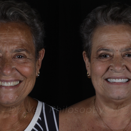 https_drveit.com.br_casos-clinicos_reabilitacao-oral-transdisciplinar-8__1