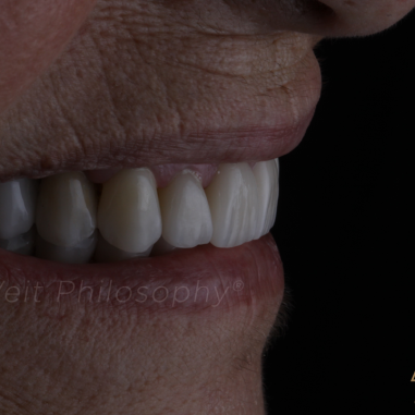 https_drveit.com.br_casos-clinicos_reabilitacao-oral-transdisciplinar-8__3