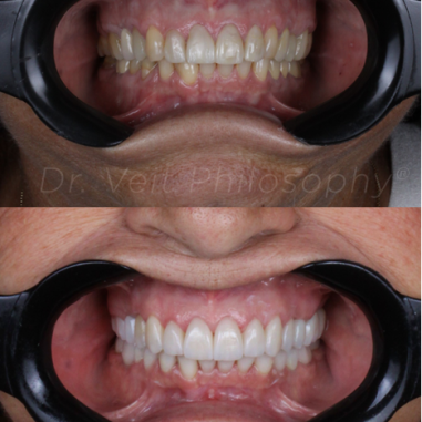 https_drveit.com.br_casos-clinicos_reabilitacao-oral-transdisciplinar-8__4