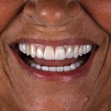 https_drveit.com.br_casos-clinicos_reabilitacao-oral-transdisciplinar-8__5