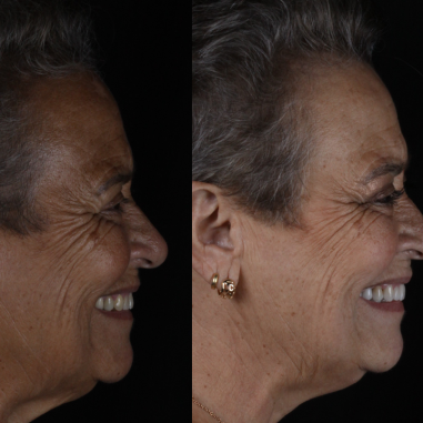 https_drveit.com.br_casos-clinicos_reabilitacao-oral-transdisciplinar-8__6