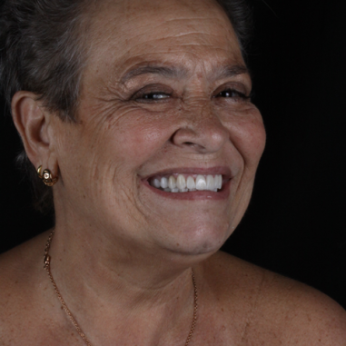 https_drveit.com.br_casos-clinicos_reabilitacao-oral-transdisciplinar-8__8