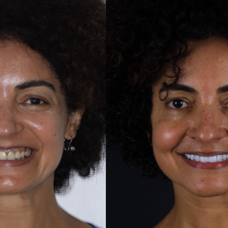 https_drveit.com.br_casos-clinicos_reabilitacao-oral-transdisciplinar-9__1