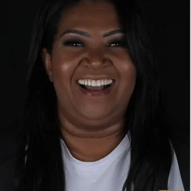 implante-carga-imediata-zirconia-veit2-10