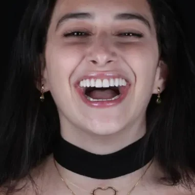 reabilitacao-oral-veit-1