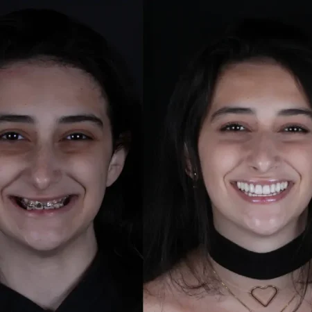 reabilitacao-oral-veit-2