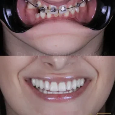 reabilitacao-oral-veit-3