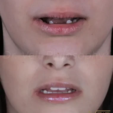 reabilitacao-oral-veit-4