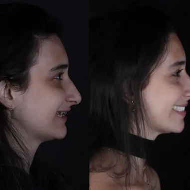 reabilitacao-oral-veit-5