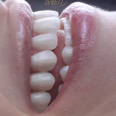 reabilitacao-oral-veit-8