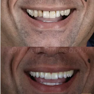 transdisciplinar-veit-4-1