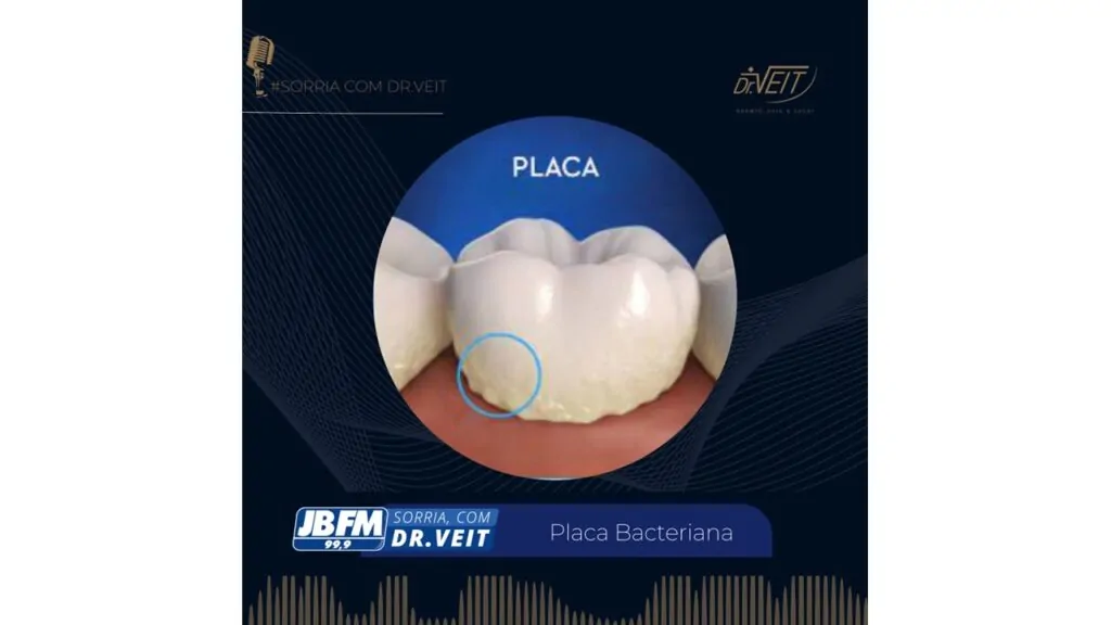 placa bacteriana