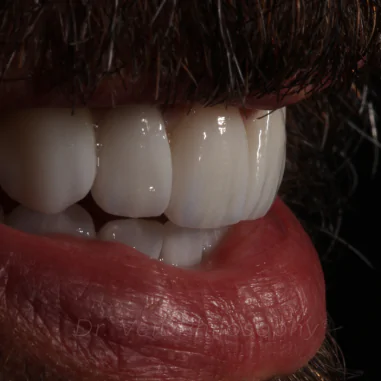 https_drveit.com.br_casos-clinicos_reabilitacao-oral-transdisciplinar-7__10