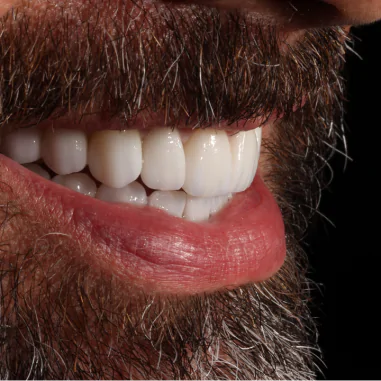 https_drveit.com.br_casos-clinicos_reabilitacao-oral-transdisciplinar-7__11