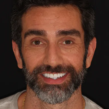 https_drveit.com.br_casos-clinicos_reabilitacao-oral-transdisciplinar-7__2