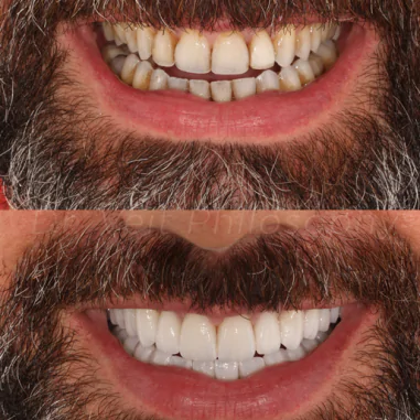 https_drveit.com.br_casos-clinicos_reabilitacao-oral-transdisciplinar-7__6