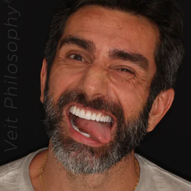 https_drveit.com.br_casos-clinicos_reabilitacao-oral-transdisciplinar-7__7