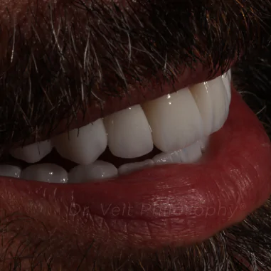 https_drveit.com.br_casos-clinicos_reabilitacao-oral-transdisciplinar-7__8