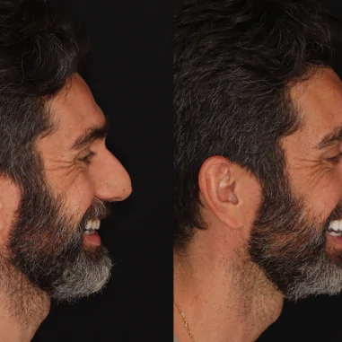 https_drveit.com.br_casos-clinicos_reabilitacao-oral-transdisciplinar-7__9